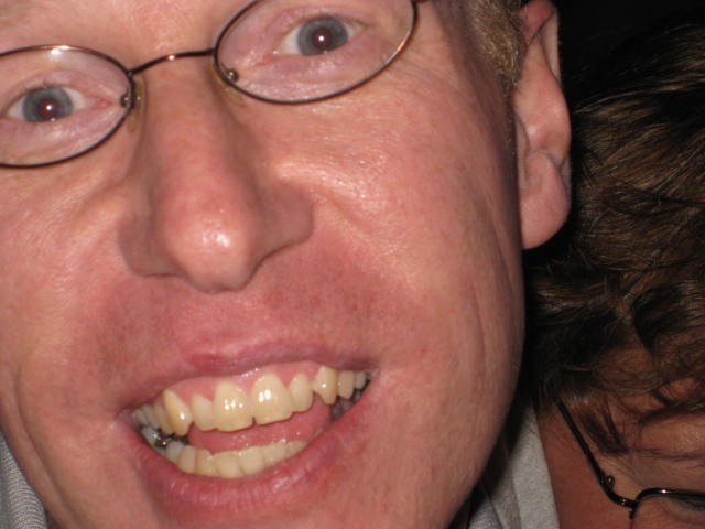 Al